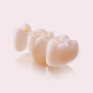 фотография мостовидного протеза для жевательных зубов