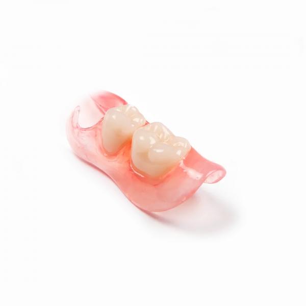 иммедиат-протез «бабочка» на 2 зуба