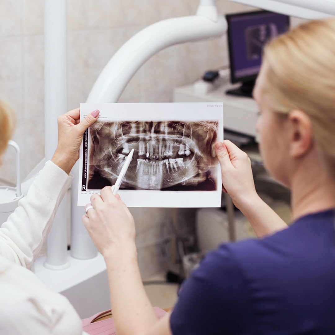 панорамный рентген снимок зубов пациента