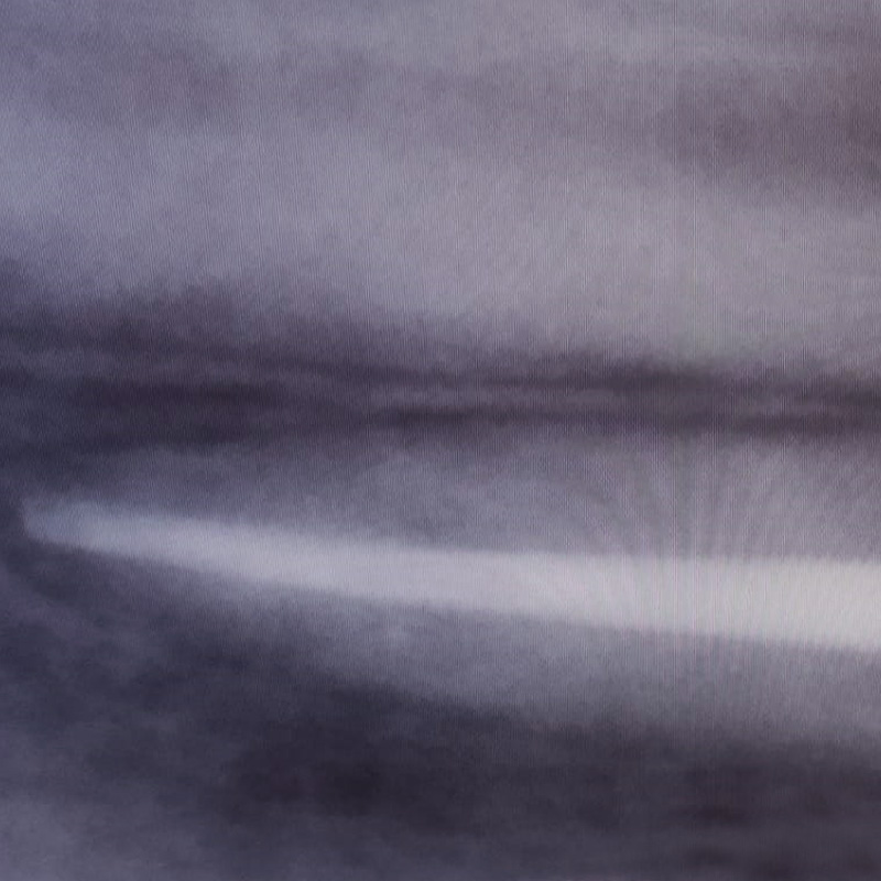Снимок после лечения пульпита переднего зуба 2
