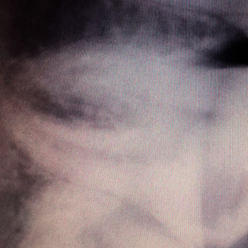 Снимок до лечения пульпита зуба 2