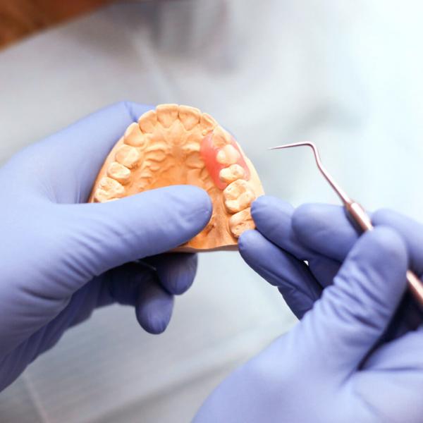 нейлоновый иммедиат-протез на один зуб