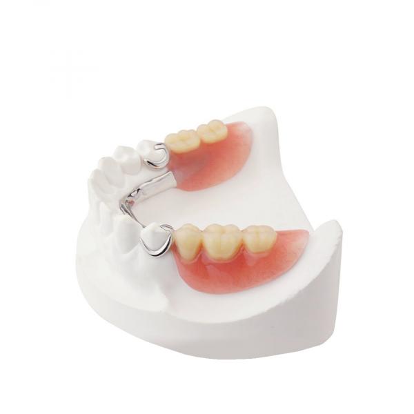 протез в зоне улыбки на несколько зубов нижней челюсти